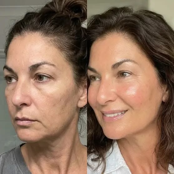 Volufiline + PDRN Multi Balm Stick